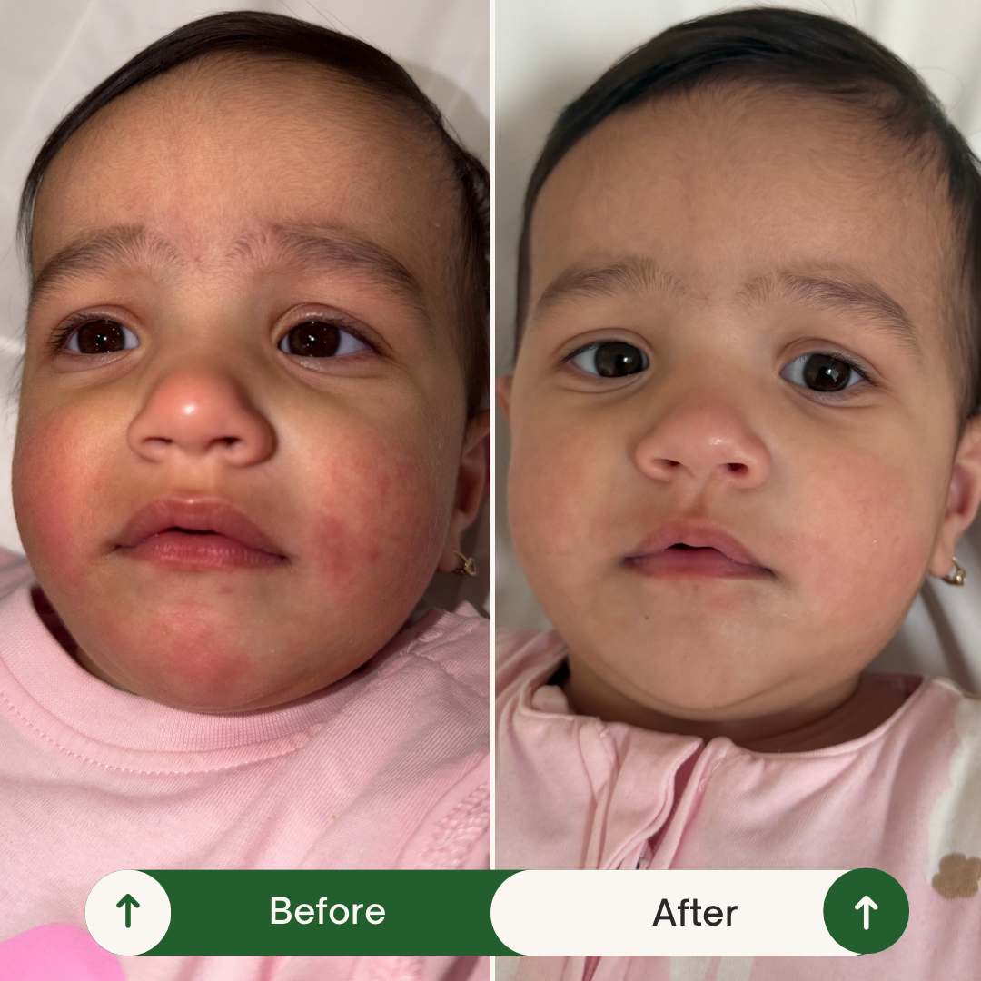 Baby touch free nappy balm